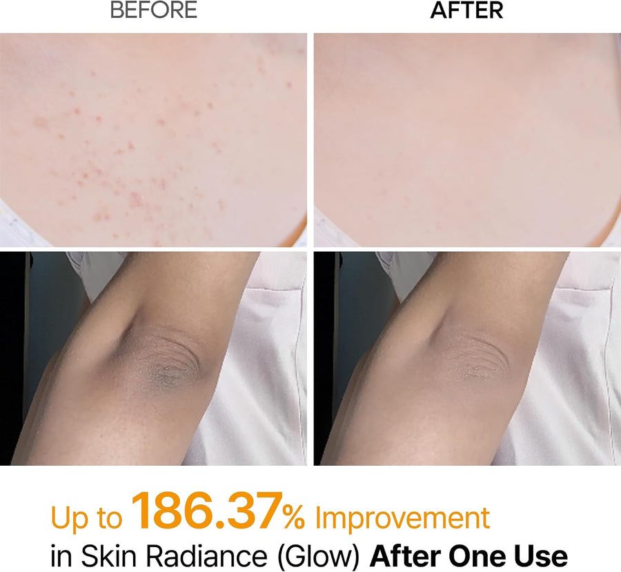 Peel Shot Dr. Melaxin